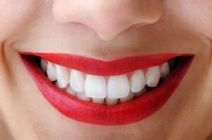 Gummy-Smile-Korrektur, Dr. Desmyttère, Zahnarzt München 