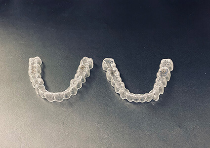 Invisalign Schiene Zahnarzt München Dr. Desmyttère 