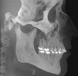 Orthodontics, Dr. Desmyttère, Dentist Munich, smileforever